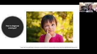 Transcriptomic Profiles in Nasal Epithelium and Asthma Endotypes in Youth