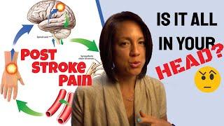 Post Stroke Pain: Fake or Real?