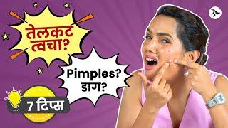 Acne Spot Removal | Oily Skin Moisturizer | Pimples Treatment at Home | Acne Scars |Urmila Nimbalkar