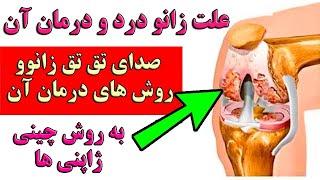 علت صدای زانو صدای تق تق زانوو روش های درمان آن