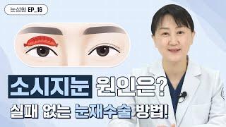 [위버스성형외과] 소세지눈 원인은?