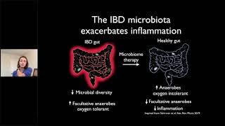 The Microbiome and IBD