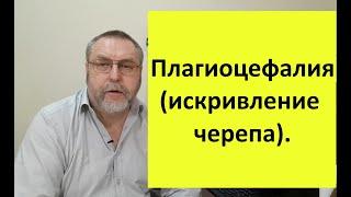 Плагиоцефалия (нарушение формы черепа). Почему возникает и что можно сделать.