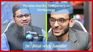 Hijama Marks; Temporary or Permanent? | Dr.Bilal With Ammar