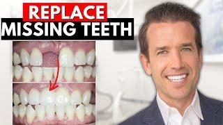 How to Replace Missing Teeth