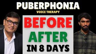 Amazing Voice Transformation: Before & After Puberphonia Therapy in Just 8 Days! | #slpsanjaykumar