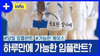 하루 만에 가능한 발치 당일, 즉시 임플란트, 원데이 임플란트가 무엇인지? 아무나 가능할까?