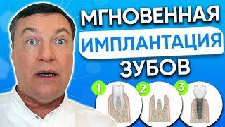 Удаление зуба и установка ИМПЛАНТА одновременно. МГНОВЕННАЯ имплантация зубов