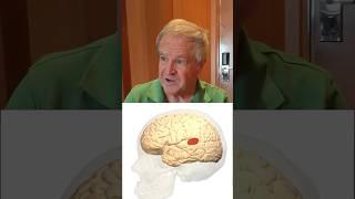 Wernicke's Aphasia #speechtherapy #aphasia #stroke