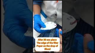 BT CT TEST | APOLLO CLINIC BALLYGUNGE PHARI