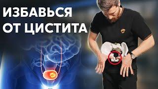 ЦИСТИТ: как избавиться? Лечение в домашних условиях