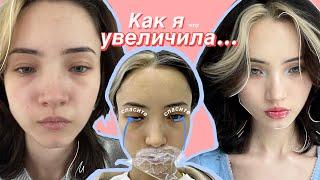 Как я увеличила губы (нервно)