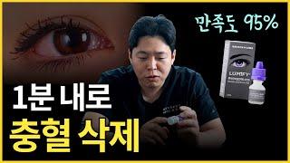 충혈을 제일 빠르고 안전하게 없애는 방법 / 처방전X 약국 구매O