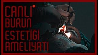 Baştan Sona Burun Estetiği Ameliyatı [ Canlı İzle 2018 ]