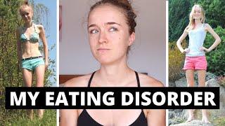 My Eating Disorder Story