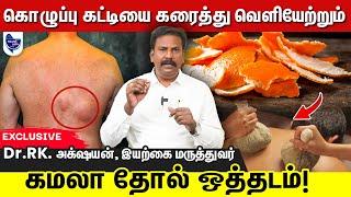 கொழுப்பு கட்டி வந்தா என்ன பண்ணனும்? | How to cure LIPOMA Naturally?