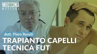 Trapianto capelli tecnica FUT - Dott. Piero Rosati