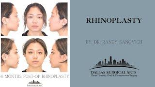 A Look Inside The OR: Rhinoplasty Surgery at Dallas Surgical Arts