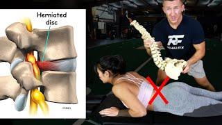 Exercises for Disc Herniation! | Disc Herniation Relief