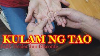Albularyo : Kinulam ng tao.mahaba ang kanang hingliliit.sa pangontra palang gumaling na.