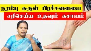 நரம்பு சுருட்டல் எதனால் ஏற்படுகிறது? தீர்வு என்ன? Varicose veins | Dr.Rajalakshmi | ASM INFO