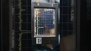 practical test of my 1/4 wave Stub Filter with effect on 96.1mhz