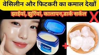 वैसलीन से काली झाइयां कैसे हटाएं सही तरीका Reduce Melasma, Pigmentation, Discolouration Blackspots