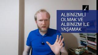 ALBİNO (ALBİNİZMLİ)  OLMAK VE ALBİNİZM İLE YAŞAMAK