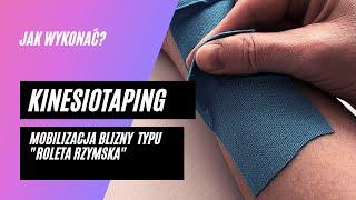 #18 Jak tejpować? - mobilizacja blizny pooperacyjnej aplikacją typu "roleta rzymska"