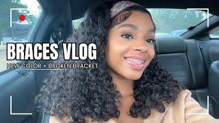 BRACES VLOG | NEW COLOR + POWER CHAINS