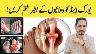 Control Uric Acid, Joint Pain & Swelling (Gout) यूरिक एसिड का इलाज - Dr Irfan Azeem