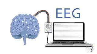 QEEG Brain Scans Explained