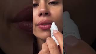 IMAGE Skincare | Hailey Bieber Loves This Lip Balm