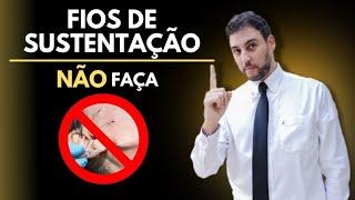 NÃO faça fios de sustentação!