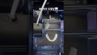 3D 치아 모형 만드는 방법 #3d프린터