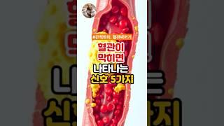 혈관이 막히면 나타나는 신호 5가지!! #건강정보 #혈관건강