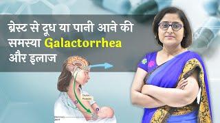छाती से पानी या फिर दूध का आना, discharge from nipple- galactorrhea