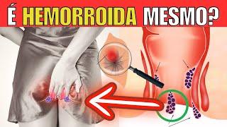 HEMORRHOIDS? WARNING SIGNS and SYMPTOMS YOU SHOULD NEVER IGNORE!