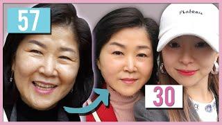 My mom got a new face with thread lift in Korea│Seoul Guide Medical