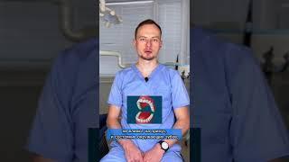 Нужно ли удалять зубы мудрости? 