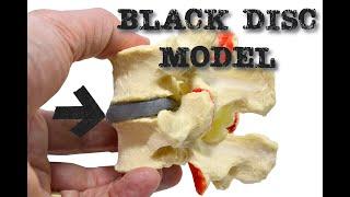 Black Disc Model by Dynamic Disc Designs