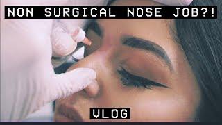 NON SURGICAL NOSE JOB?! VLOG