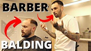 DEALING With BALDING AT The BARBERSHOP