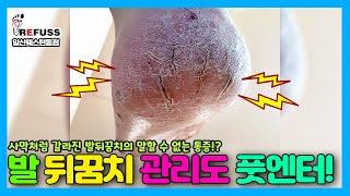 발 뒤꿈치 관리도 풋엔터테인먼트에서!! 사막의 땅처럼 갈라진 발뒤꿈치의 말할수 없는 통증 관리하기! #레푸스 #레푸스일산 #내성발톱 #일산각질 #일산발각질 #toenail #발톱