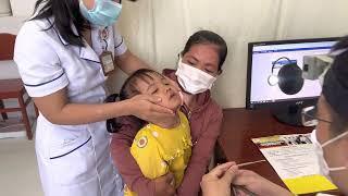 Nasal foreign body removal for child | Doctor Anh