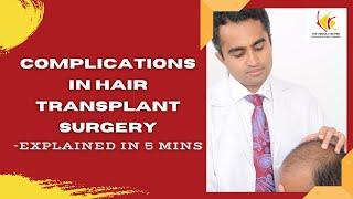 Worried about complications in Hair Transplant Surgery? Risks & side Effects Involved (explained)