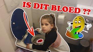 "MAMA IK HEB BLOED GESPUUGD" KOETLIFE VLOG