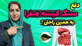 دفع سنگ کیسه صفرا بدون عمل جراحی: نسخه ای شگفت انگیز برای دفع سنگ کیسه صفرا