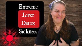 Facing EXTREME Liver Detox~ Please Never Ignore Pain ^ Sickness