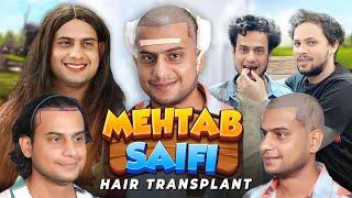 YouTuber Mehtab Saifi Hair Transplant | Experience Before and After Surgery